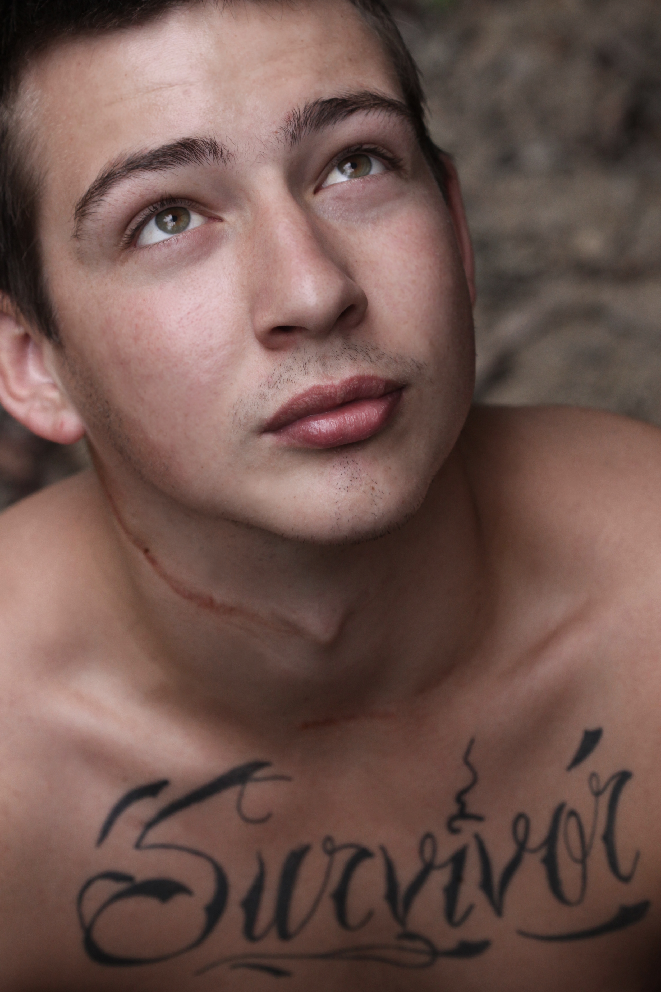 Scar Stories Brandon Osteosarcoma by Lisa Auger.jpg