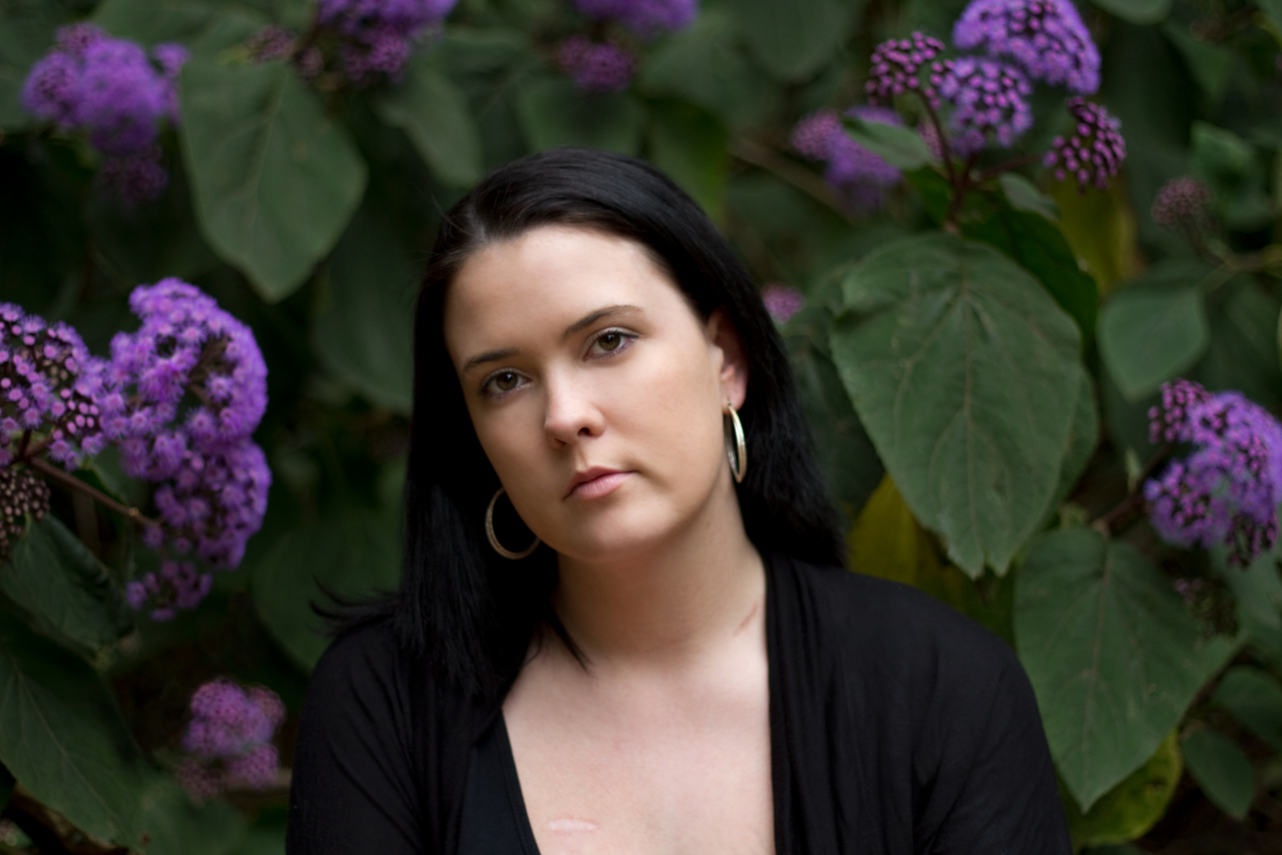 Scar Stories Erin Hodgkins Lymphoma by Brihanna Rilstone.jpg