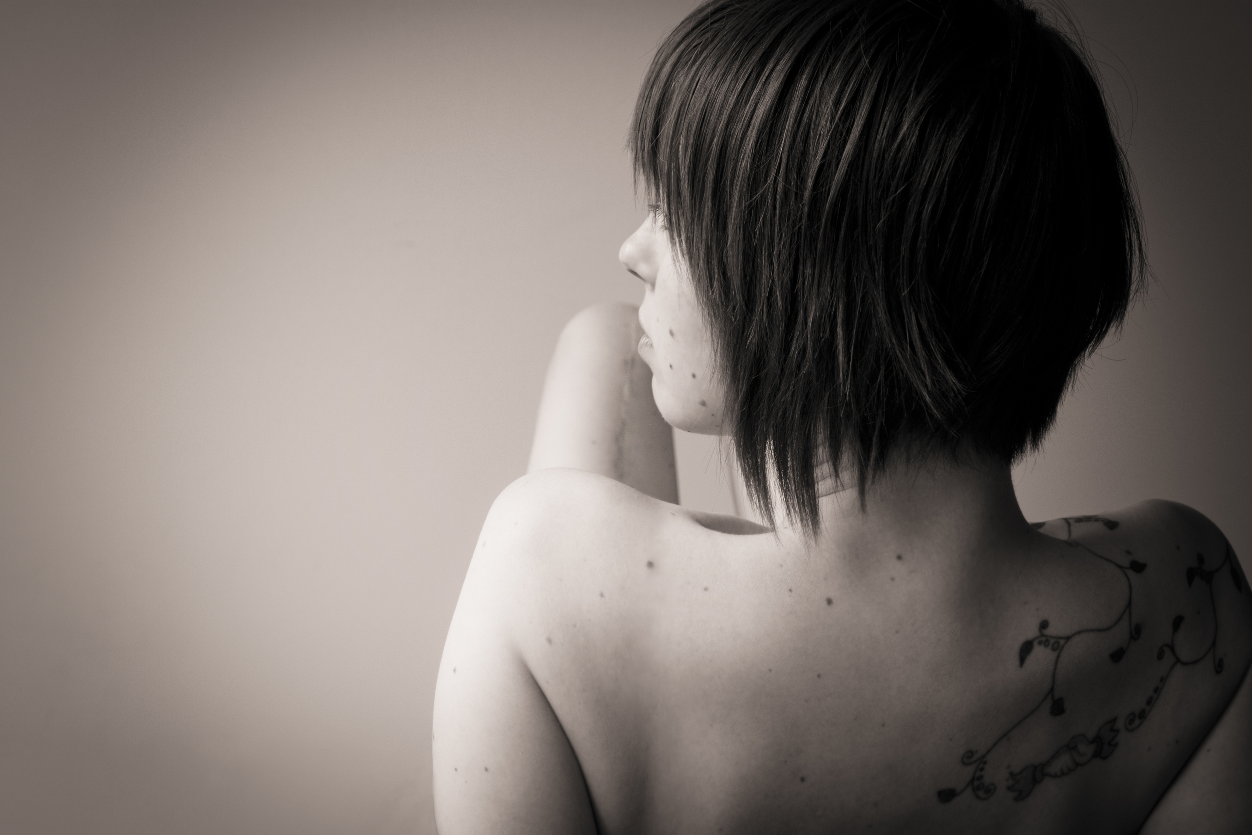 Scar Stories Lucy Ewings Sarcoma by April Kendall.jpg