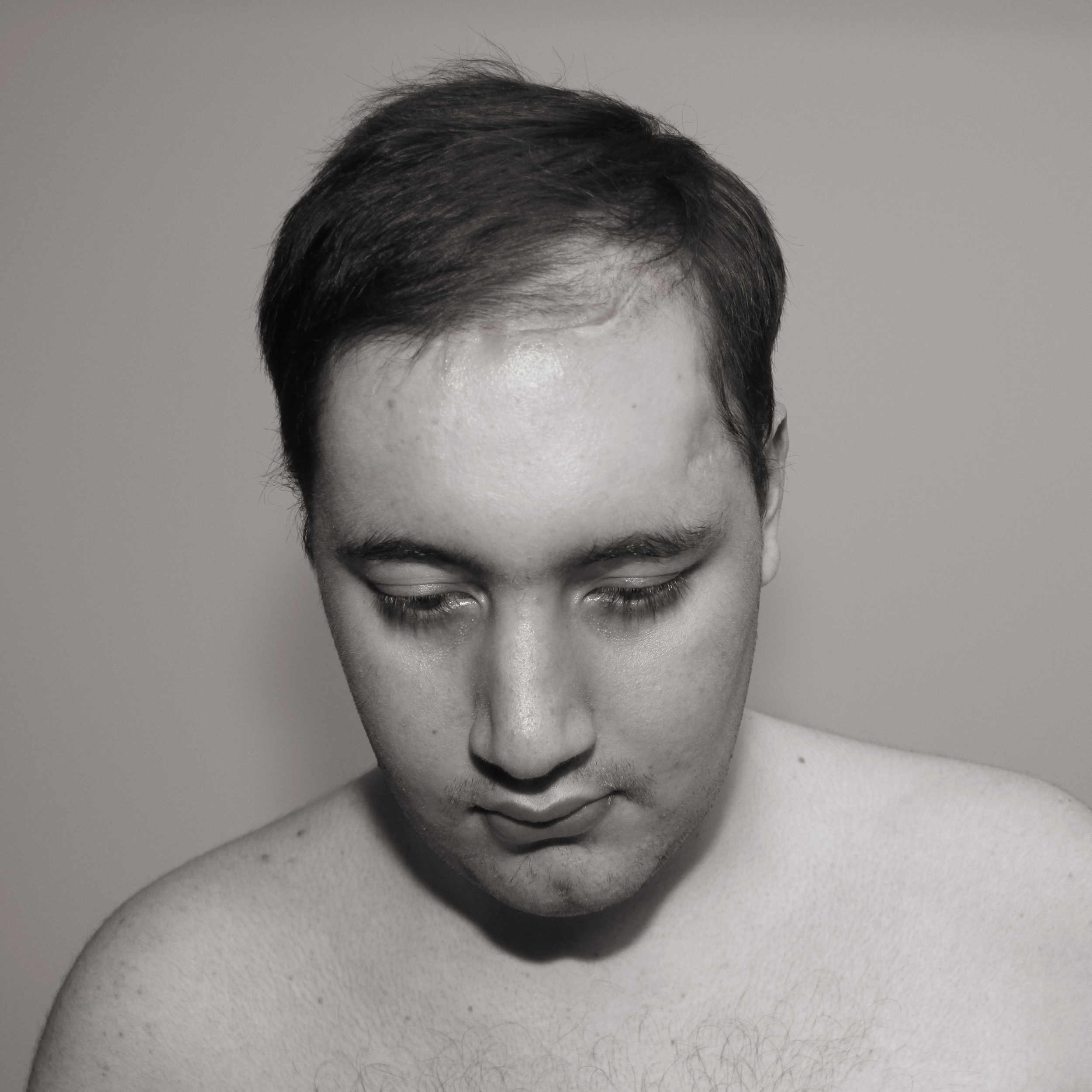 Scar Stories Nathan Brain Tumour by Lisa Auger.jpg