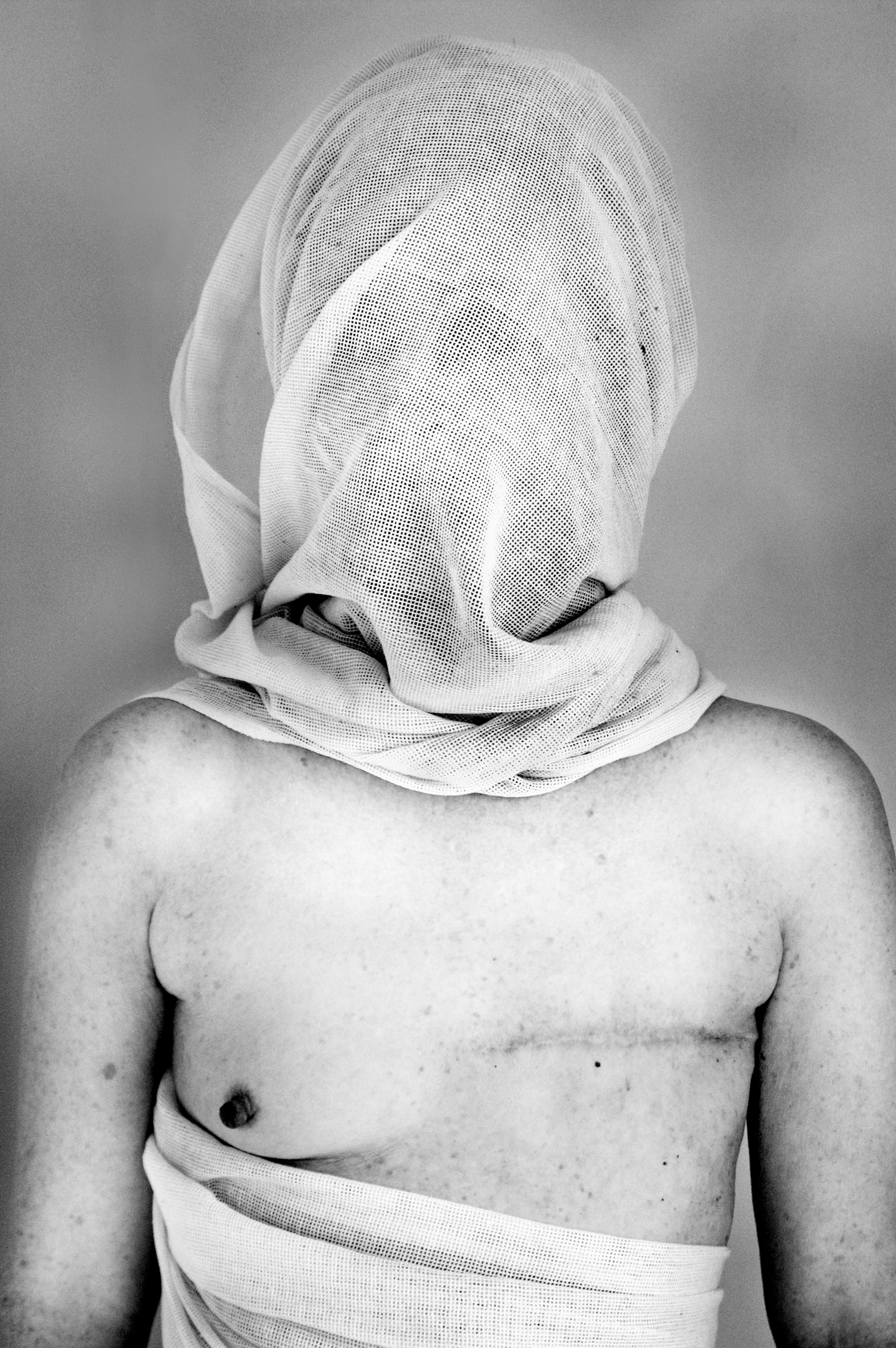 Scar Stories Wendy Breast Cancer by Charmaine Lyons.jpg