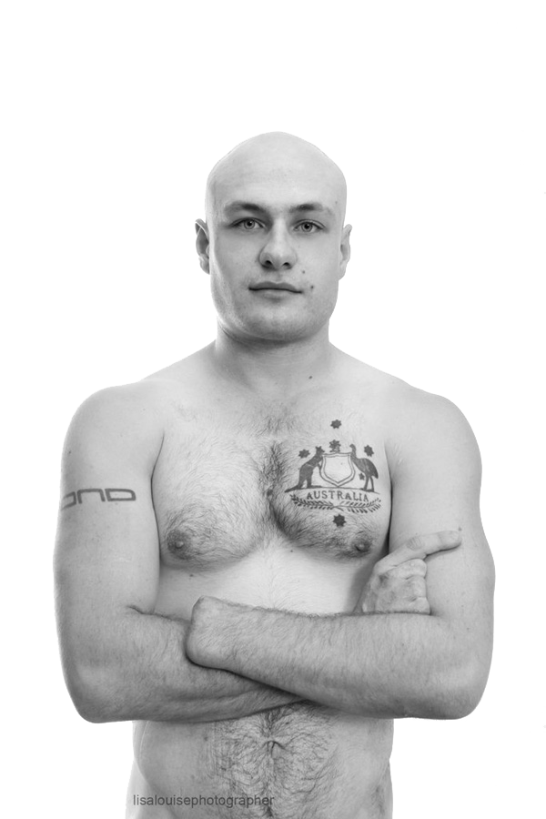 Scar Stories: Chris, bone cancer survivor