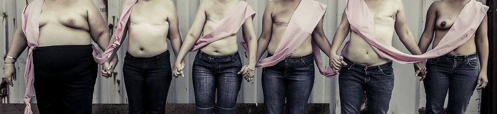 TBCs, Breast Cancer Survivors & Victims by Suzanne McCorkell