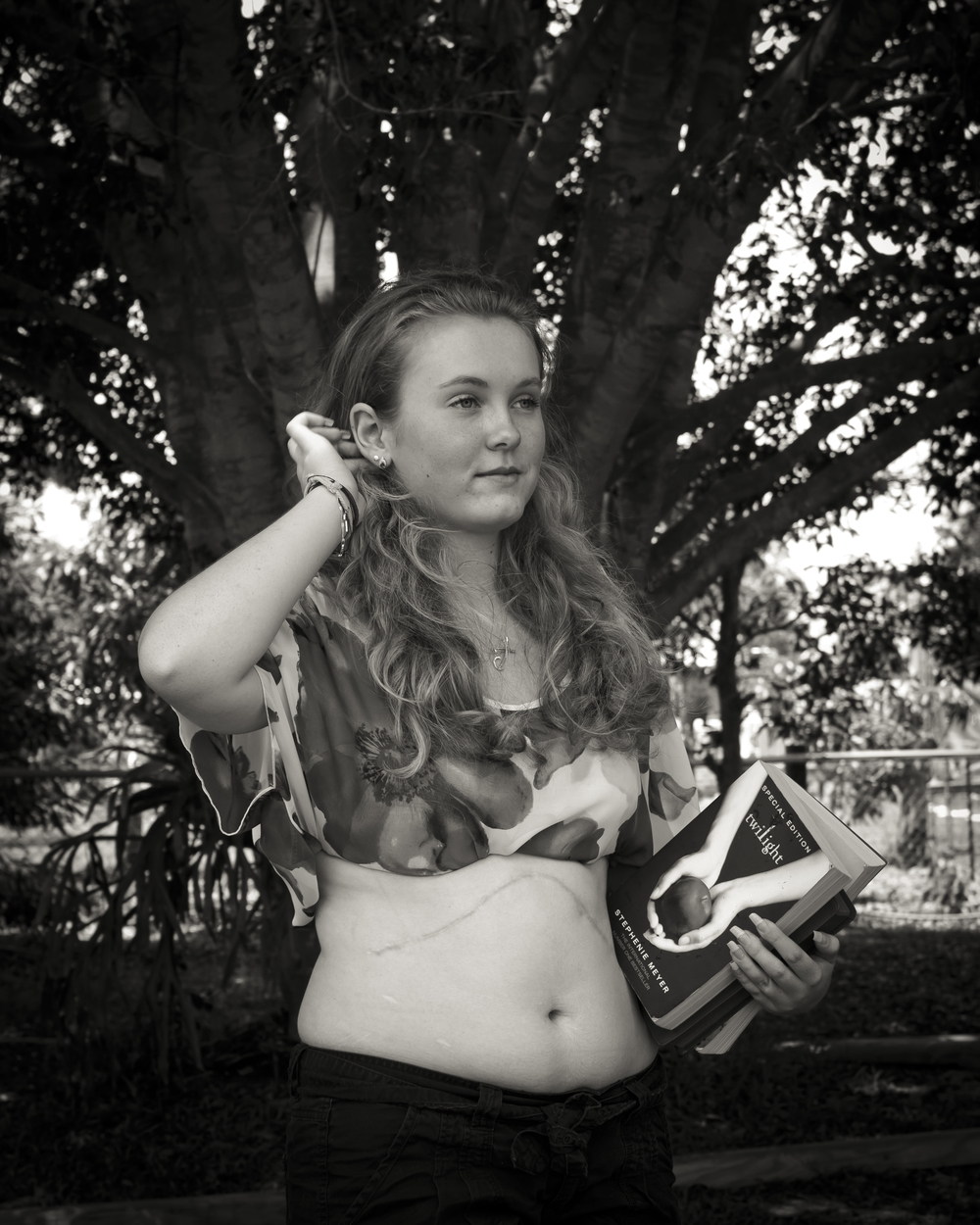 Charlotte, Liver Tumour Survivor by Steve Tyssen