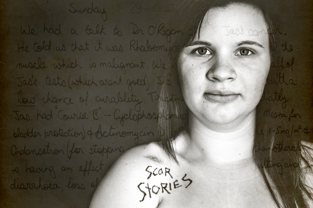 Jas, Rhabdomyosarcoma Survivor by Charmaine Lyons