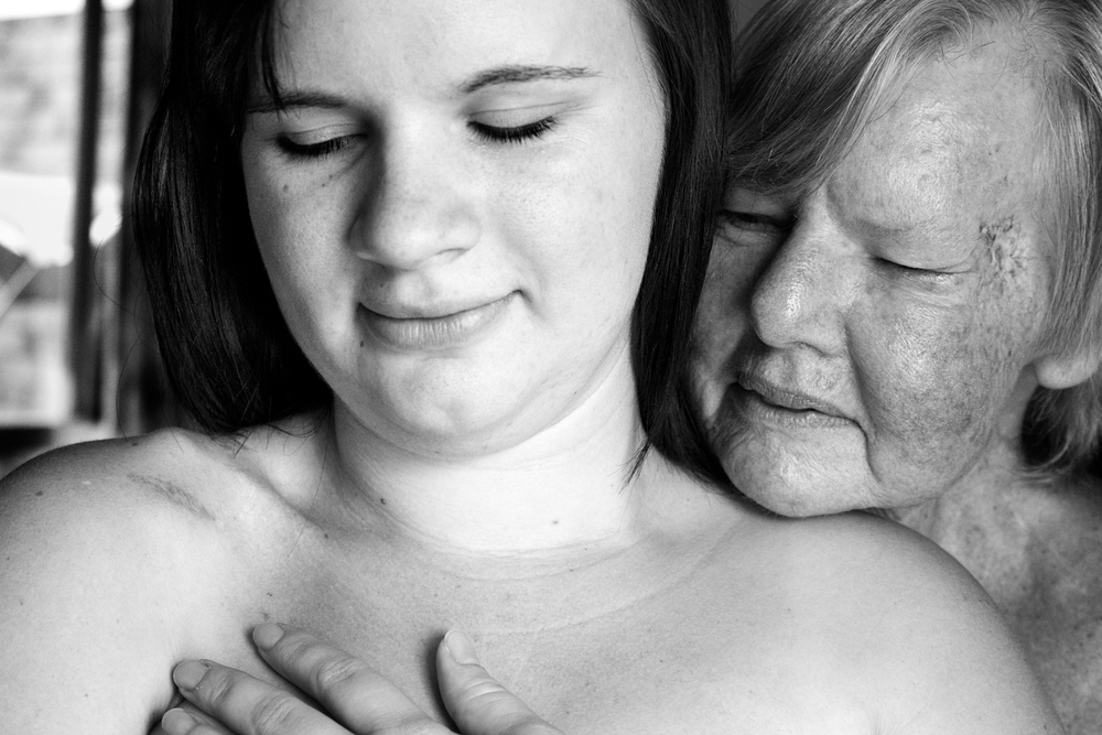 Jas, Rhabdomyosarcoma Survivor & Sue, Melanoma Survivor, by Charmaine Lyons
